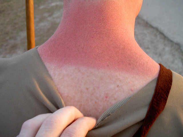 50 shades of pale - TheCity