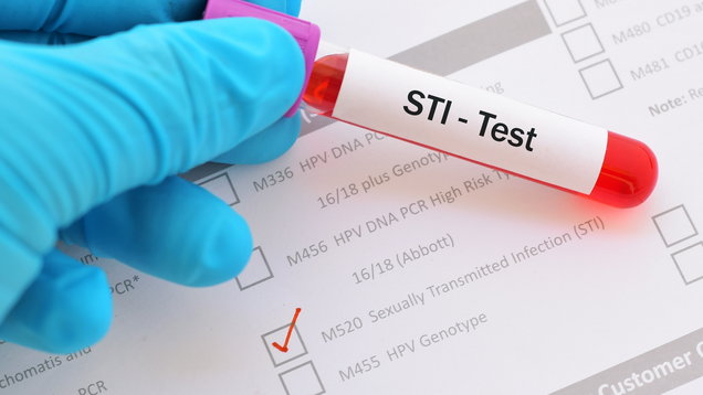 STIs are most common in young adults