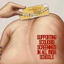 Patients Still Face Long Wait Times for Essential Spinal Surgery in Ireland 